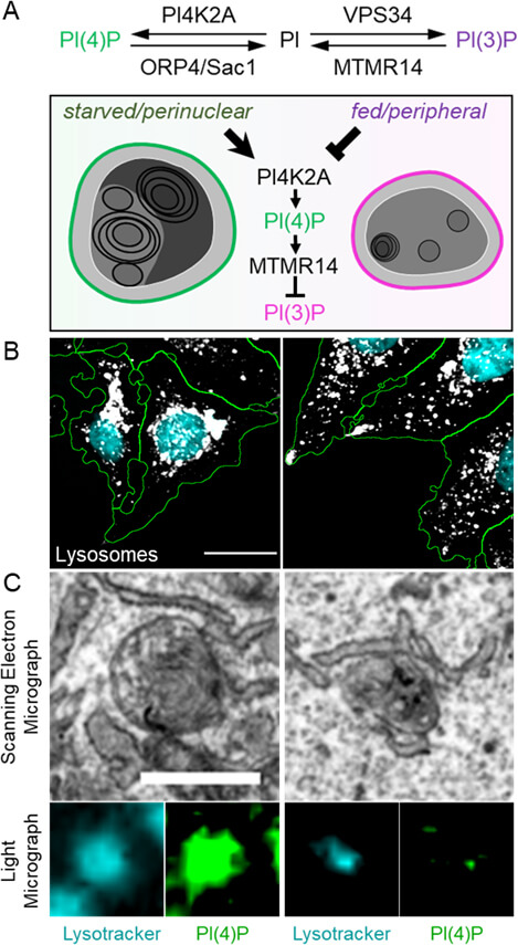 A) The nutrient-dependent transformation of lysosomes is controlled by enzymes that can interconvert the signaling lipids PI(4)P and PI(3)P. B) In starvation (left) and nutrient-rich conditions (right), lysosomes display different subcellular localization patterns. C) Imaging techniques that can combine electron and light microscopy reveal the ultrastructure of lysosomes (marked with lysotracker) with different levels of specific signaling lipids (PI(4)P in green). © Michael Ebner