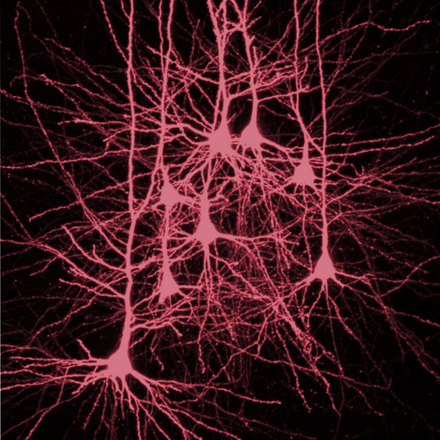 Neurons in the neocortex: Slow-wave sleep strengthens the connections between them, supporting memory formation. © Charité | Sabine Grosser